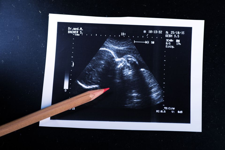 Ultraschallbild bei Schwangerschaft