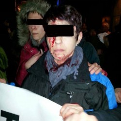 Von Linksextremisten in Frankfurt verletzte Pegida-Demonstrantin Foto: facebook