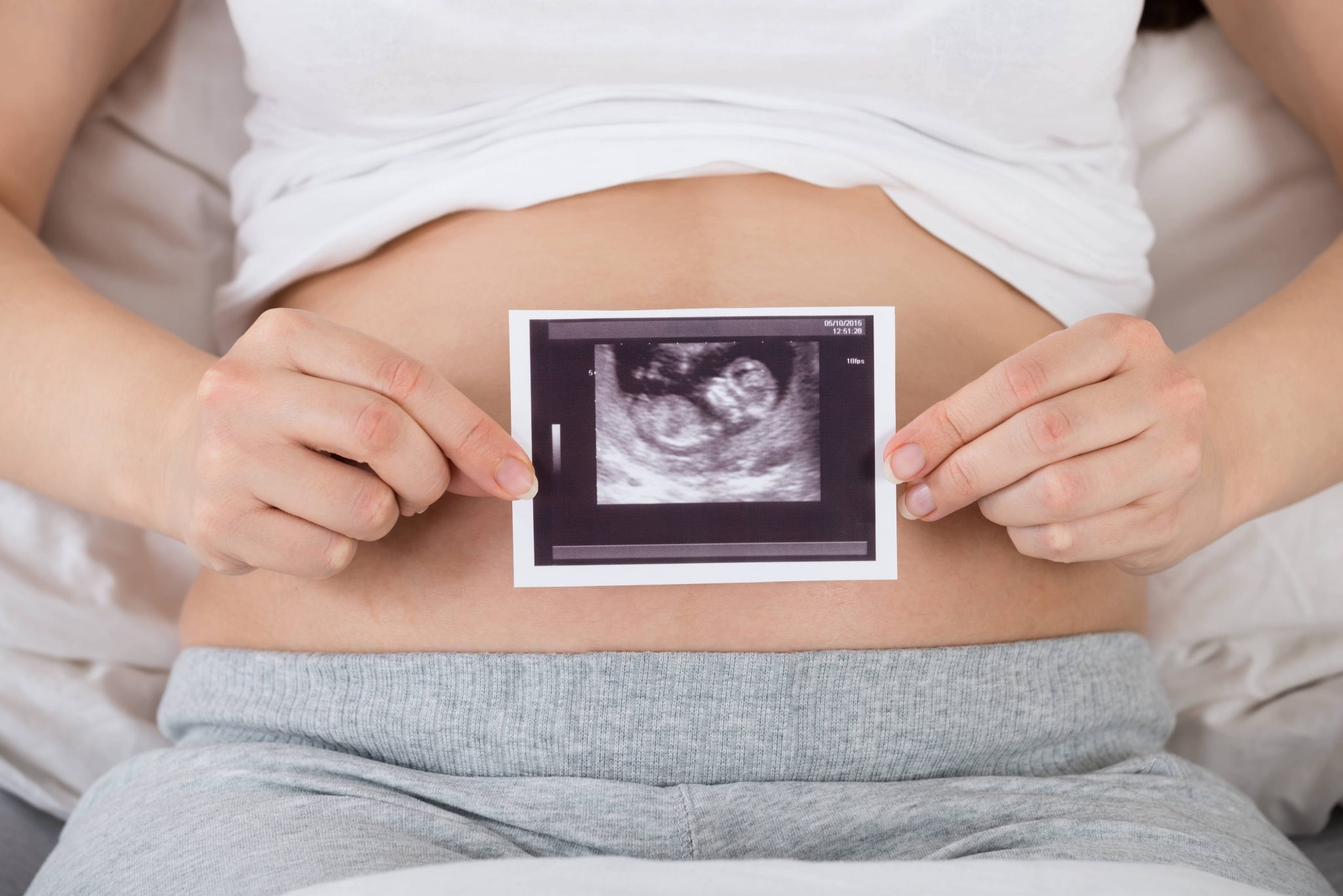 Schwangere mit Ultraschallbild