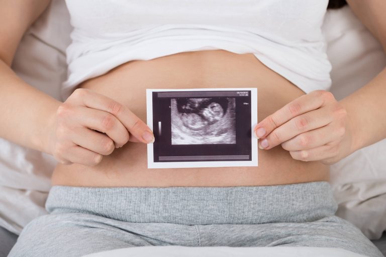Schwangere mit Ultraschallbild