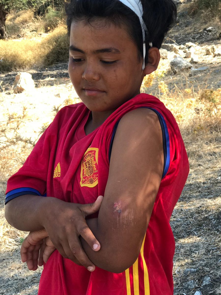 Dieser afghanische Junge zeigt seine Verletzung Foto: JF 