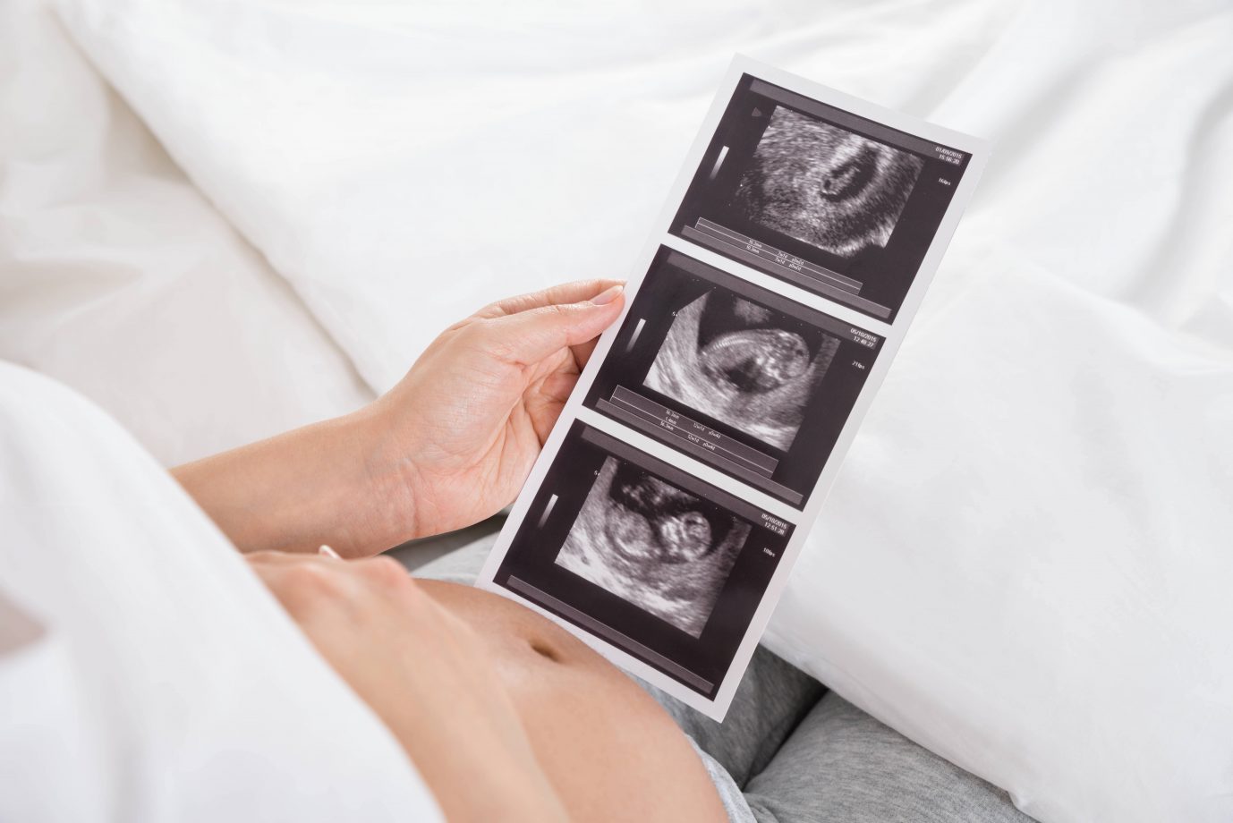 Frau hält Ultraschallbild in der Hand: Die CDU erinnert daran, daß die Menschenwürde auch ungeborenen Kindern zusteht