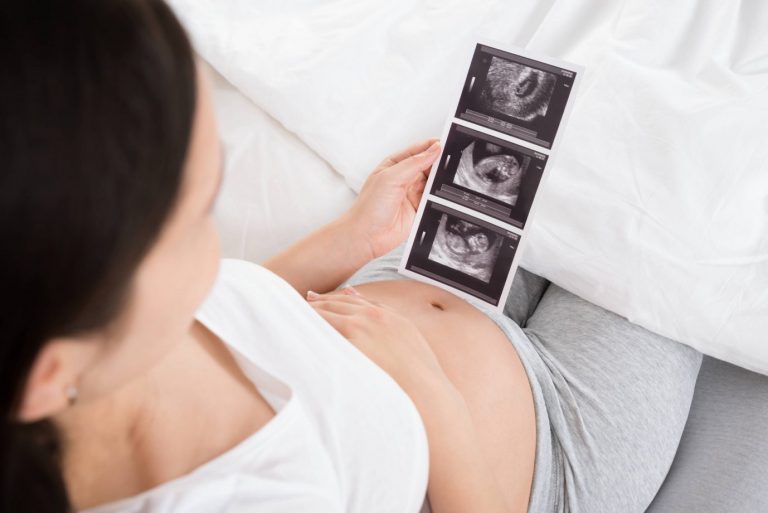 Schwangere Frau hält Ultraschallbild in der Hand: Amazon will seinen Mitarbeiterinnen in den USA die Reisekosten bei Abtreibungen bezahlen