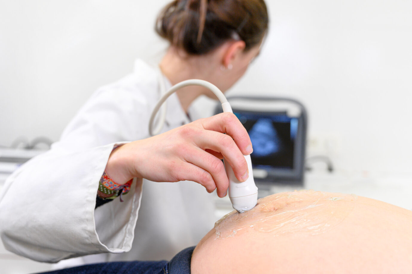 Ultraschalluntersuchung bei einer schwangeren Frau: Das Europaparlament will das Töten ungeborener Kinder in die Charta der Grundrechte der Europäischen Union aufnehmen