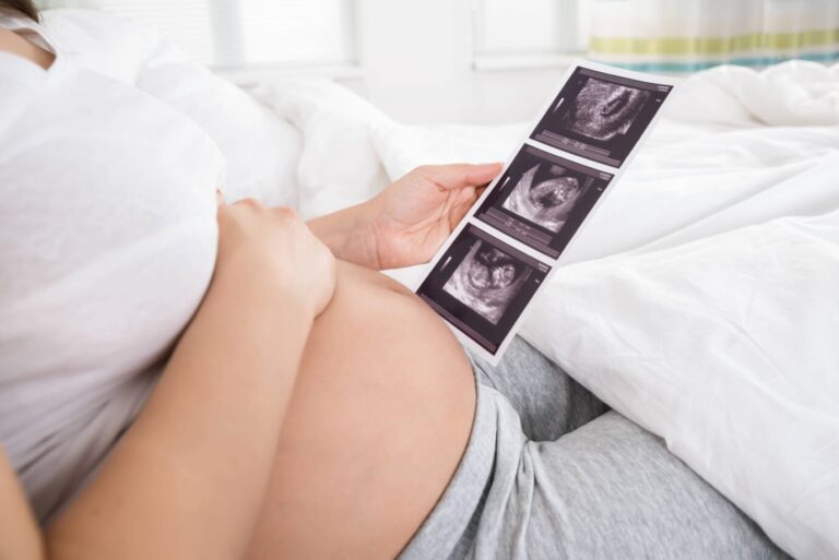 Eine schwangere Frau fäßt sich an den Bauch und blickt auf ein Ultraschallbild, das ihr ungeborenes Kind zeigt