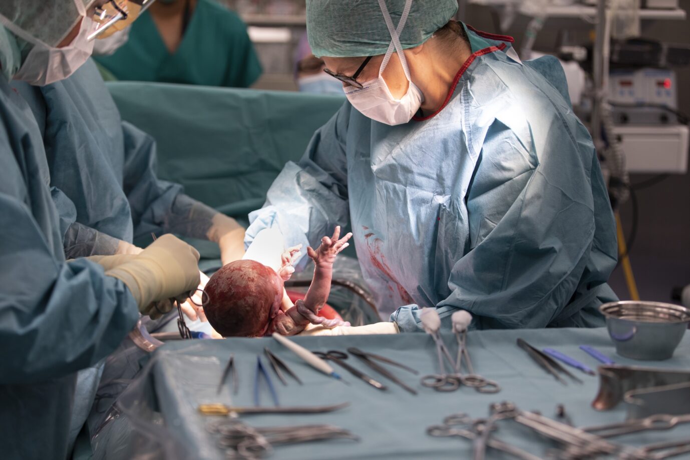Ärzte entbinden ein Neugeborenes per Kaiserschnitt – die Technik birgt Gefahren für Mutter sowohl als auch für das Kind
