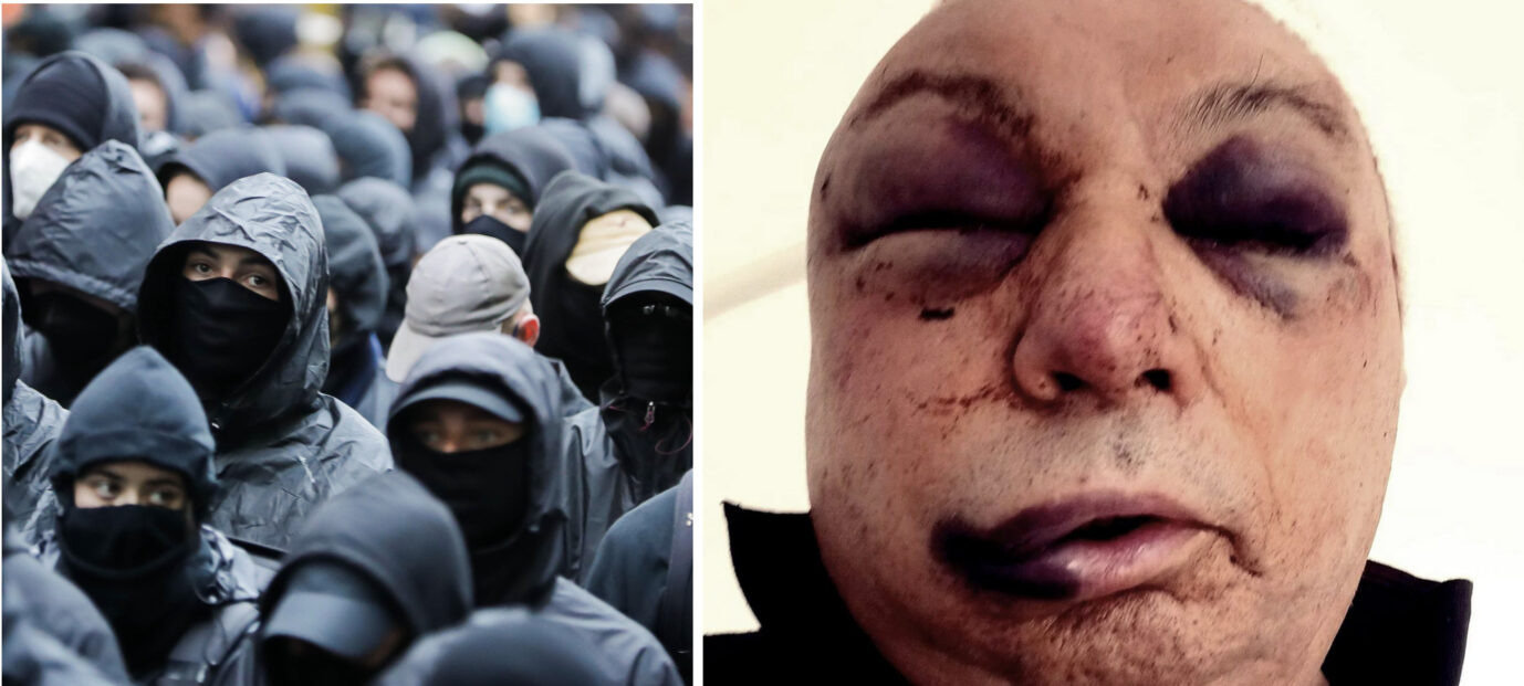 Anhänger der linksradikalen Szene in Berlin (Symbolbild) und eines der Verletzten von Budapest, der Rechtsrocker László Dudog