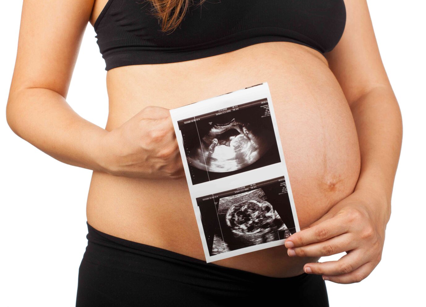 Der Bauch einer schwangeren Frau. Die Frau hält ein Ultraschallbild ihres Babies in die Kamera. Sie will keine Abtreibung.