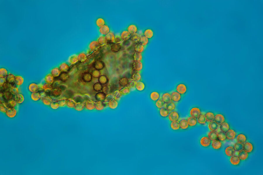 Auf dem Foto befinden sich Sporen eines Pilzes unter dem Mikroskop. (Symbolbild)