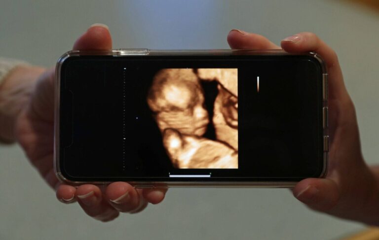 Ultraschallbild auf Handy (Symbolfoto): Scharfe Kritik an neuen Abtreibungsregeln. Foto: IMAGO / ZUMA Press Wire