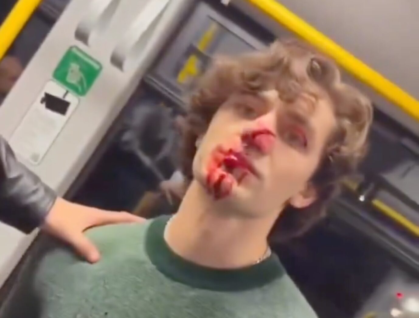 Der US-Amerikaner, der in einer S-Bahn Frauen half und zusammengeschlagen wurde. Merkel zeigt dann woanders Gesicht.