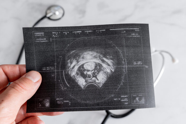 Die EU will den Zugang zu Abtreibungen vereinfachen. Symbolbild: picture alliance / CHROMORANGE | Michael Bihlmayer