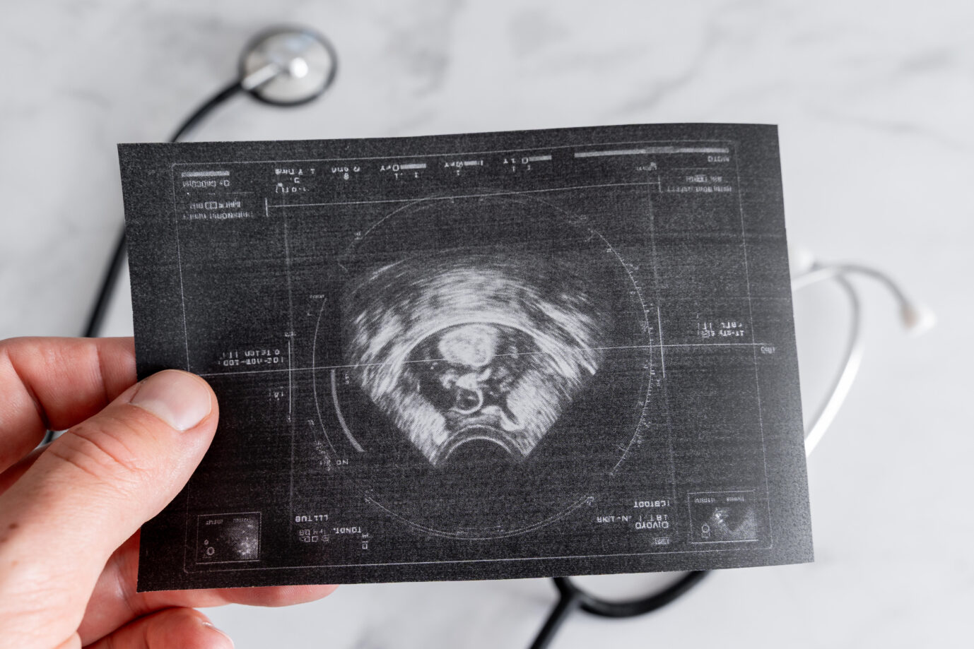 Die EU will den Zugang zu Abtreibungen vereinfachen. Symbolbild: picture alliance / CHROMORANGE | Michael Bihlmayer