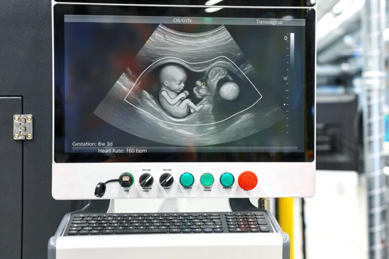 Eine US-Leihmutter weigert sich, das herzkranke Baby in ihrem Bauch abtreiben zu lassen. Die Auftraggeber fordern Schadenersatz. Symbolbild: picture alliance / CHROMORANGE | MICHAEL BIHLMAYER