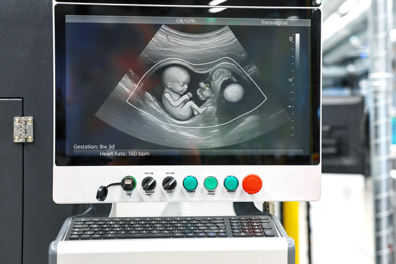 Eine US-Leihmutter weigert sich, das herzkranke Baby in ihrem Bauch abtreiben zu lassen. Die Auftraggeber fordern Schadenersatz. Symbolbild: picture alliance / CHROMORANGE | MICHAEL BIHLMAYER