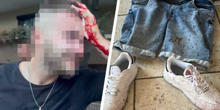 Man sieht einen blutenden Mann und daneben blutverschmierte Kleidung und Schuhe, Szenen eines linksextremen Überfalls