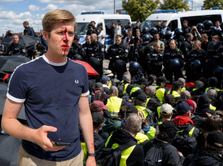 Der AfD-Nachwuchspolitiker Michael Schumann wurde beim Angriff von Linksextremen verletzt.